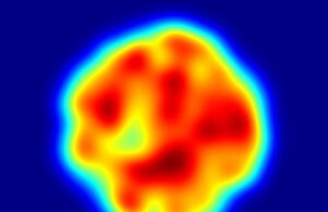 What is a Beam Homogenizer?
